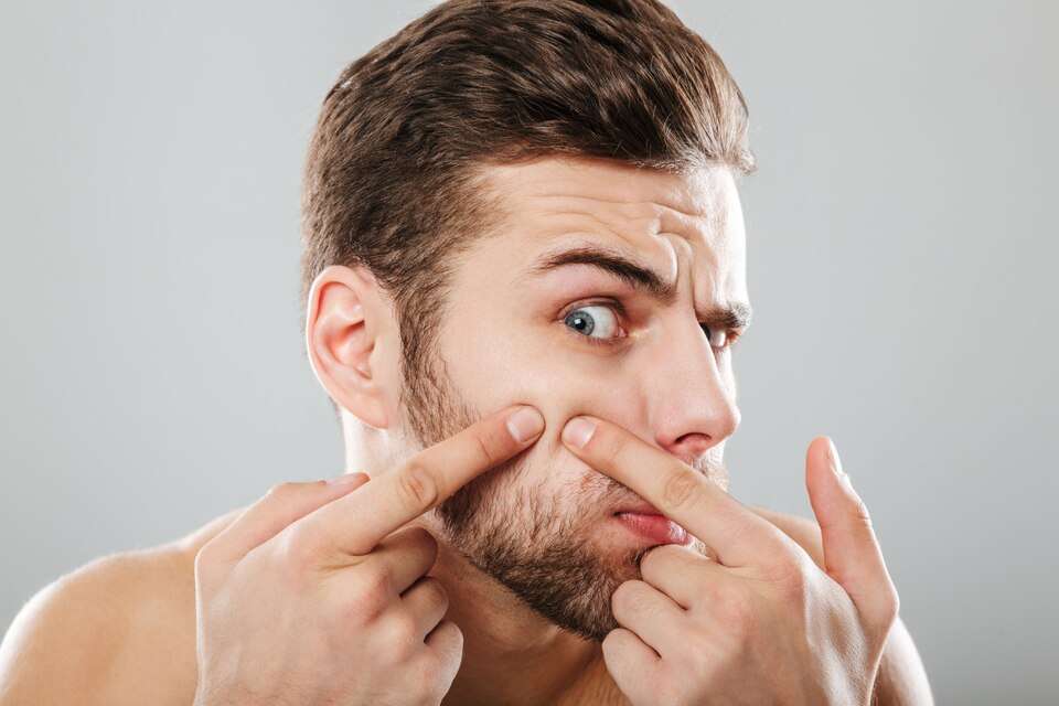 8 Simple Methods To Eliminate Beard Acne