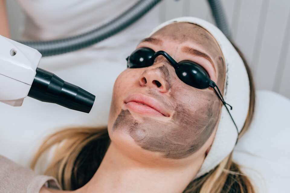 How Long Does Laser Acne Laser Treatment Take?